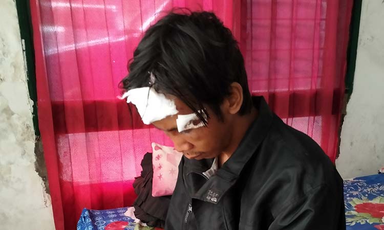 LUKA-LUKA: Korban Rizky Hendrawan, 28, saat ditemui di rumahnya di Dusun Puntir, Desa Martopuro, Purwosari, (17/11). Dia dikeroyok sekelompok pemuda yang diduga geng motor Minggu (16/11) dini