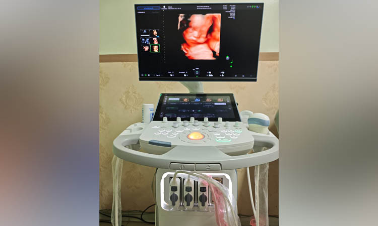 SUDAH TERSEDIA: Alat USG 4D Obgyn di RSUD grati yang memungkinkan orang tua bisa melihat aktivitas janin.