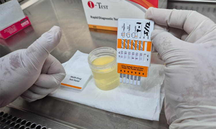 LENGKAP: Uji laboratorium tes urine untuk mengetahui pasien positif atau negatif narkotika di puskesmas IPWL.