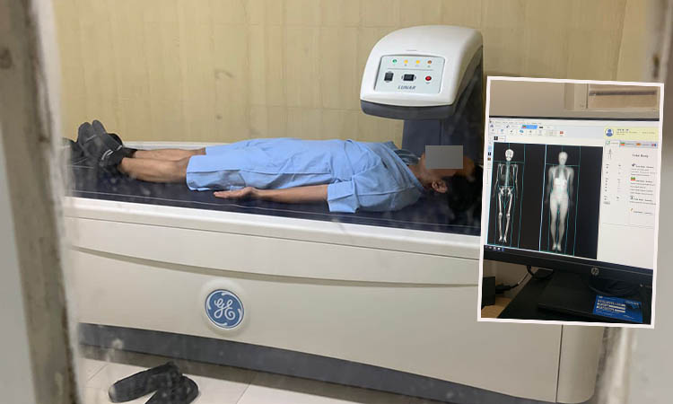 TINGKATKAN PELAYANAN: Seorang pasien saat sedang diperiksa menggunakan alat kedokteraan baru Bone Mineral Density.Inset : Alat baru yang dimiliki RSUD Bangil yakni Bone Mineral Density.