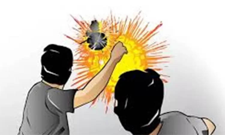 Ilustrasi bondet