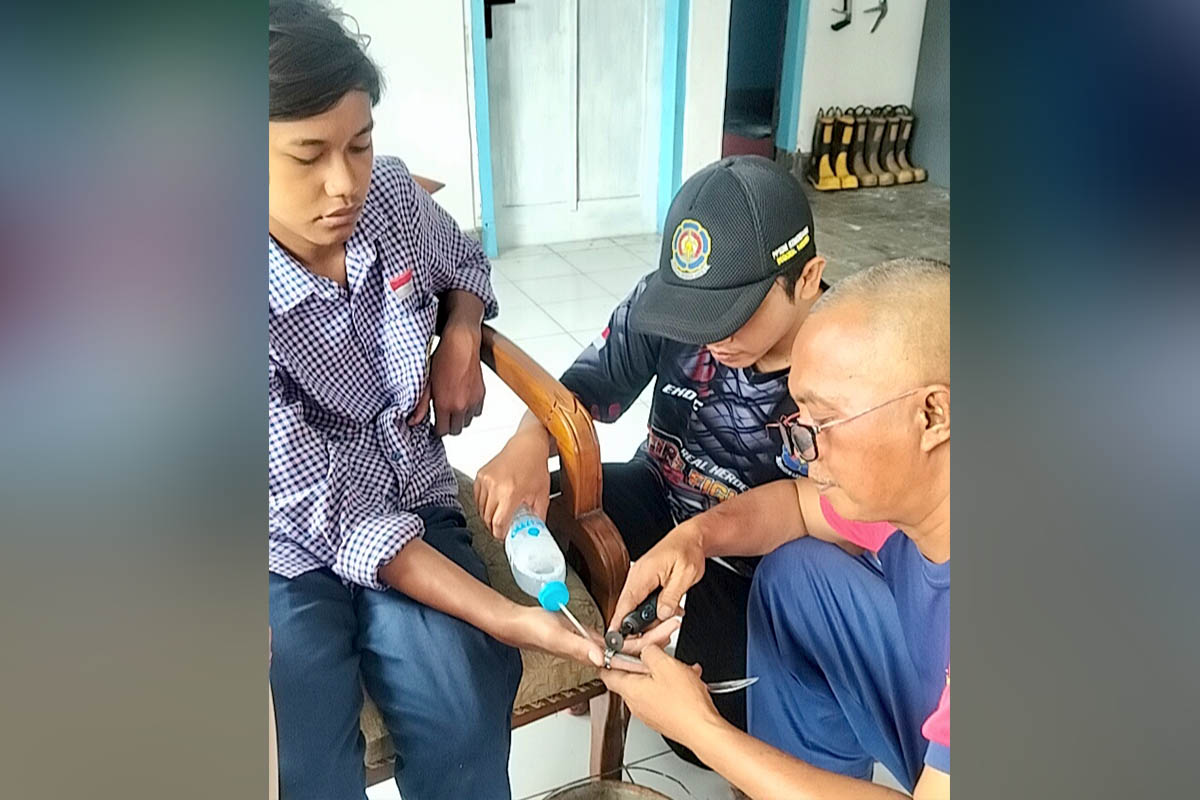 HATI-HATI: Damkar Unit Tongas berhati-hati mengevakuasi cincin yang tak bisa lepas di jari telunjuk kanan Ahmad Riski.
