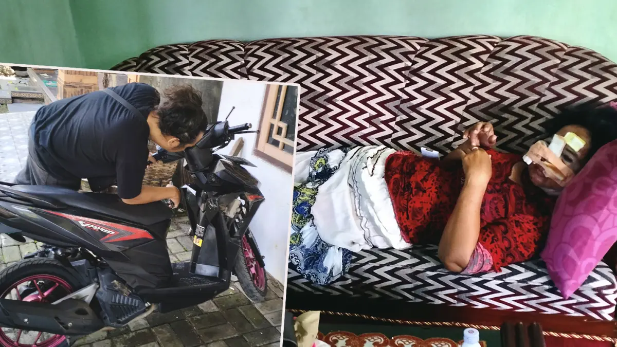 ALAMI LUKA DI WAJAH: Korban saat ditemui di rumahnya. Inset motor korban juga alami sejumlah kerusakan. (Achmad Arianto/ Radar Bromo)