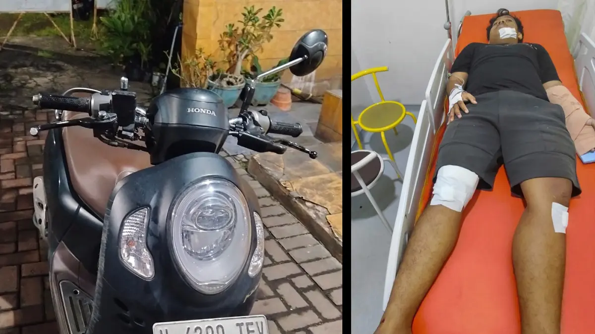 DIAMANKAN: Motor Honda Scoopy yang dikendarai korban. Inset kondisi korban saat dirawat. 