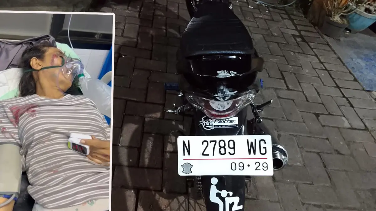 DIAMANKAN: Motor korban saat diamankan, inset korban saat dirawat (foto kiri)