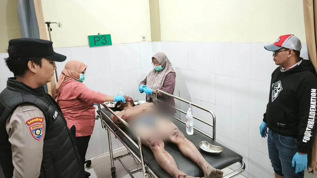 AMATIRAN: Tersangka IN, pelaku curanmor yang babak belur saat perawatan medis di IGD Puskesmas Nongkojajar. (Foto: Polsek Nongkojajar for Jawa Pos Radar Bromo)