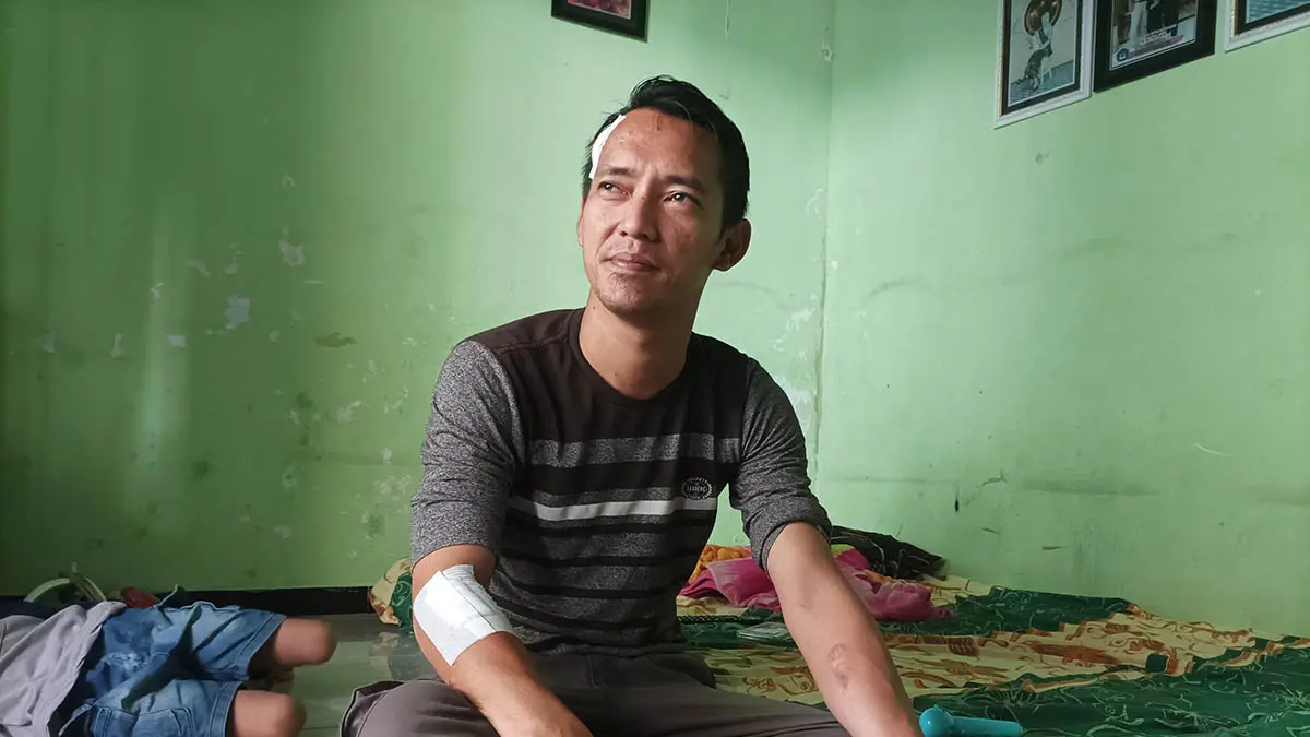 TERLUKA: Nugroho Priyo Wicaksono, warga Perumahan Kraksaan Permai, Desa Sidopekso, Kecamatan Kraksaan, yang mengaku dibegal Senin (1/6) malam. (Foto: Agus Faiz Musleh/Jawa Pos Radar Bromo)
