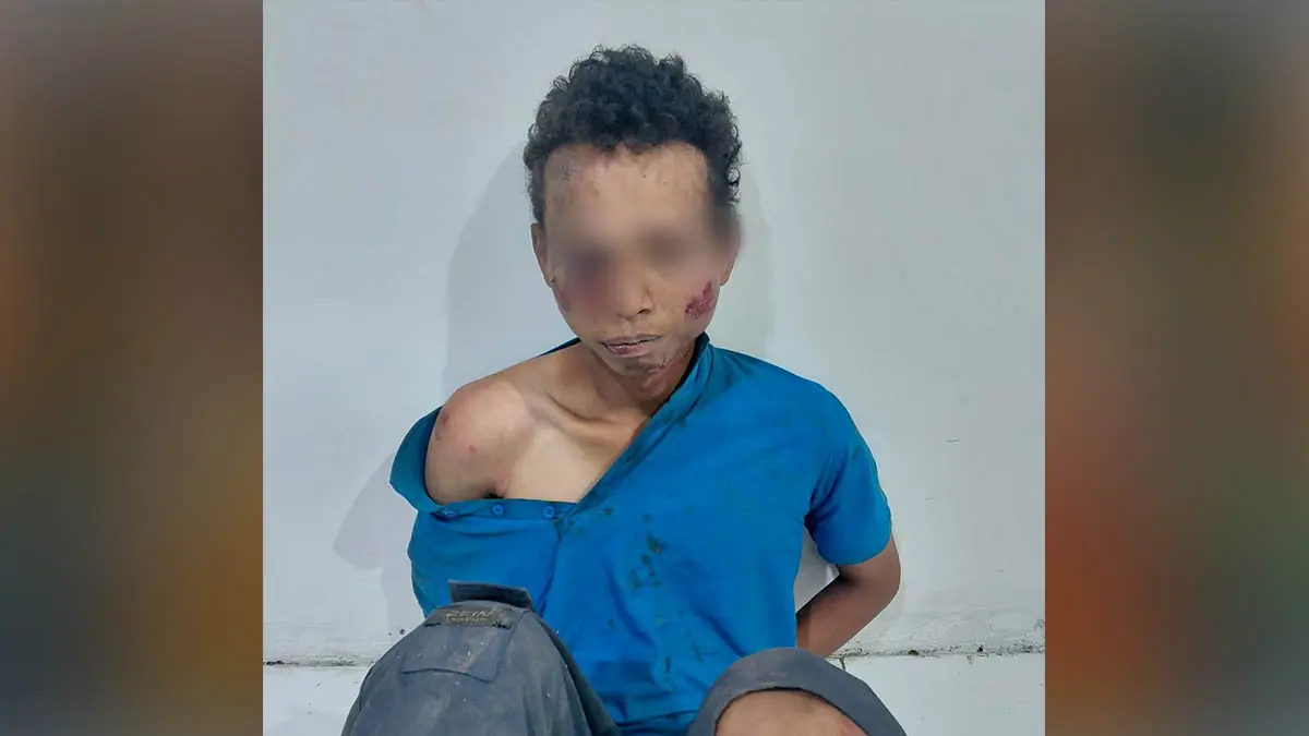 BONYOK: AS, warga asal Pati, Jateng yang babak belur dimassa usai tepergok membawa kabur tas. (Foto: Polsek Gempol for Jawa Pos Radar Bromo)