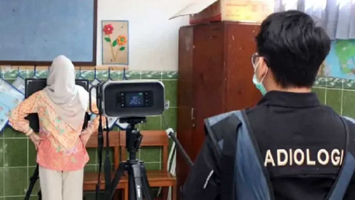 SKRINING: Skrining menggunakan pemeriksaan rontgen atau X-ray, salah satu metode yang dilakukan Dinkes P2KB Kabupaten Pasuruan untuk mendeteksi kemungkinan paparan TBC di lingkungan sekolah, maupun komunitas.