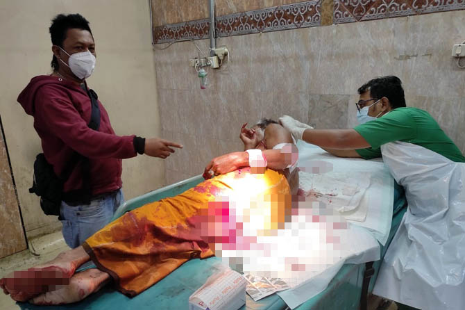 ALAMI LUKA BACOK: Korban Abdus Sakur saat mendapat perawatan di IGD RSUD dr Soedarsono, Purut, Kota Pasuruan, Senin pagi (1/3). (Istimewa)
