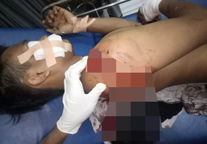 LUKA SABETAN: Eko Wahyudi ditangani tim medis RSUD dr Moh Soleh, usai dibacok kawannya, Senin (24/5) sore. (Foto: Polsek Kuripan for Jawa Pos Radar Bromo)