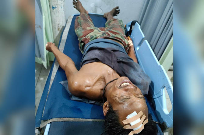 LUKA BACOK: Asâ€™ari saat dirawat di IGD Puskesmas Sukorejo. Ia mengalami luka bacok di dahi dan luka di jarinya. (Rizal Syatori/ Radar Bromo)