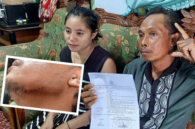 LAPOR POLISI: Ahmad Saihu yang menunjukkan jahitan atas luka yang diterimanya. (Rizky Putra Dinasti/Jawa Pos Radar Bromo)