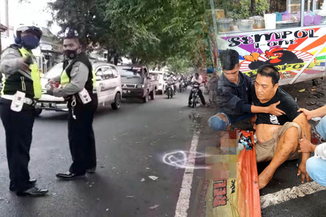 LUKA BERAT: Fredy Darmawan mengalami luka berat setelah kecelakaan di Jalan Cokroaminoto, Kota Probolinggo, Sabtu (22/1). (Istimewa)