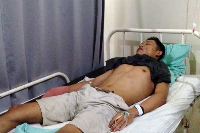 LUKA BACOK: Korban Hanif Samsul, 27, menjalani perawatan di RS Asih Abyakta Gempol setelah dibacok di tangan dan beberapa bagian tubuhnya oleh begal motor.