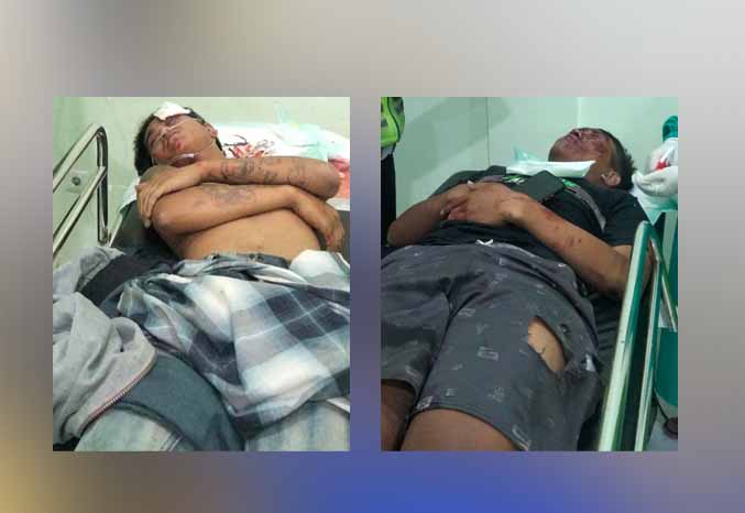 MASUK IGD: Dua dari tiga orban saat dirawat di rumah sakit. (Foto: Unit Lantas Polsek Pandaan for Jawa Pos Radar Bromo)