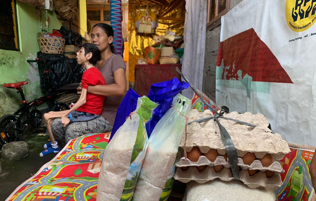 Salah satu dari tiga balita penderita mikrosefallus di Kabupaten Tabanan yang beralamat di Pandak Gede Kecamatan Kediri, Tabanan Bali.