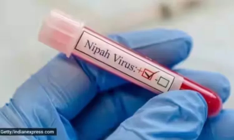 Ilustrasi virus Nipah.