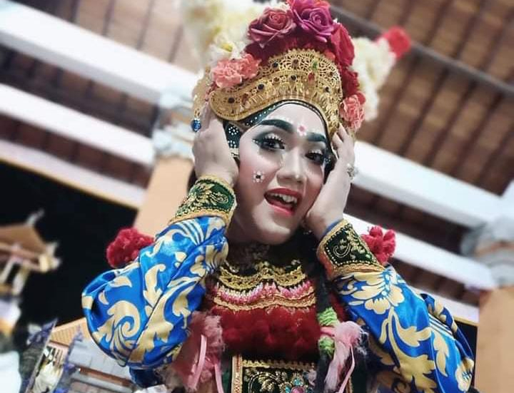 Penari Liku Gek Cerling sedang terbaring di rumah sakit akibat alami kecelakaan