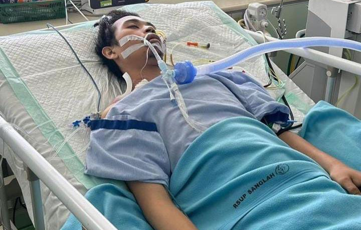 Valentinus Andhika Yudi Pratama dalam kondisi kritis usa menjadi korban pengeroyokan dan penusukan di Bali