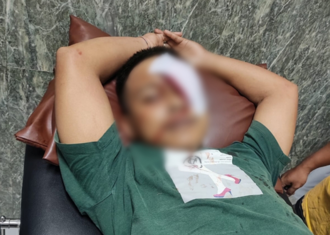 Terluka: Warga Banjar Kehen, Kesiman Pentilan terluka terkena lemparan batu.