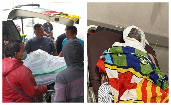Korban kebakaran gudang LPG di Jalan Cargo Taman I, Denpasar tewas di RS Prof Ngoerah, Denpasar.