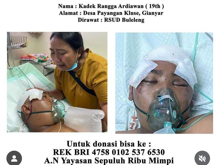 Kadek Rangga Ardiawan, 19 terbaring lemah di Rsud Buleleng usai mengalami kecelakaan