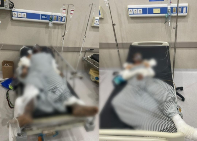 Nyoman Parta doakan dua korban ledakan Gudang gas LPG selamat agar bisa menjadi saksi korban
