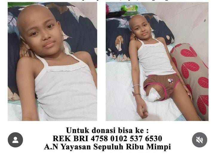 Ni Made Ayu Sintya Adnyani alami kanker tulang
