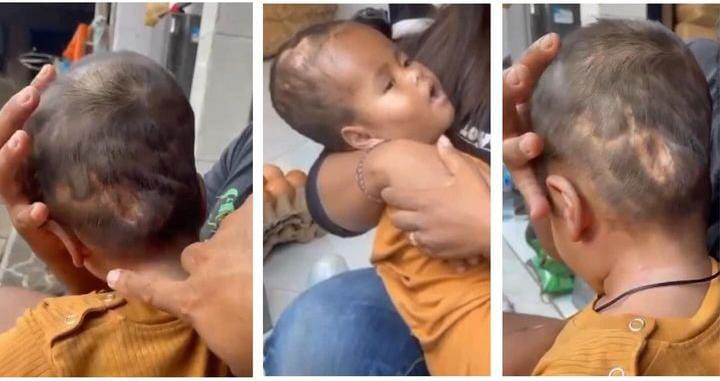 Komang Gede Windu Sancaya butuh banyak biaya untuk pengobatan