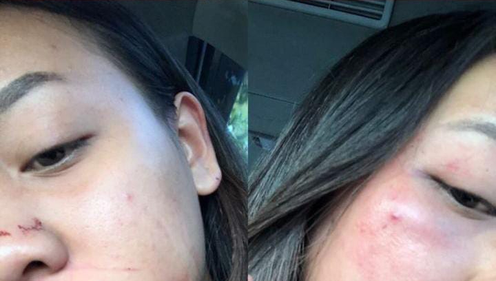 Viral di Instagram seorang gadis alami kekerasan yang diduga dilakukan oleh mantan kekasih