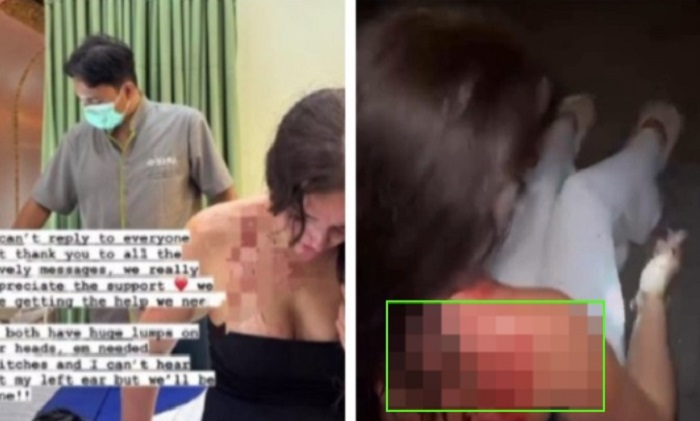 Bule wanita asal Inggris diserang orang tak dikenal di Kuta Utara, Bali, dan dirampok.