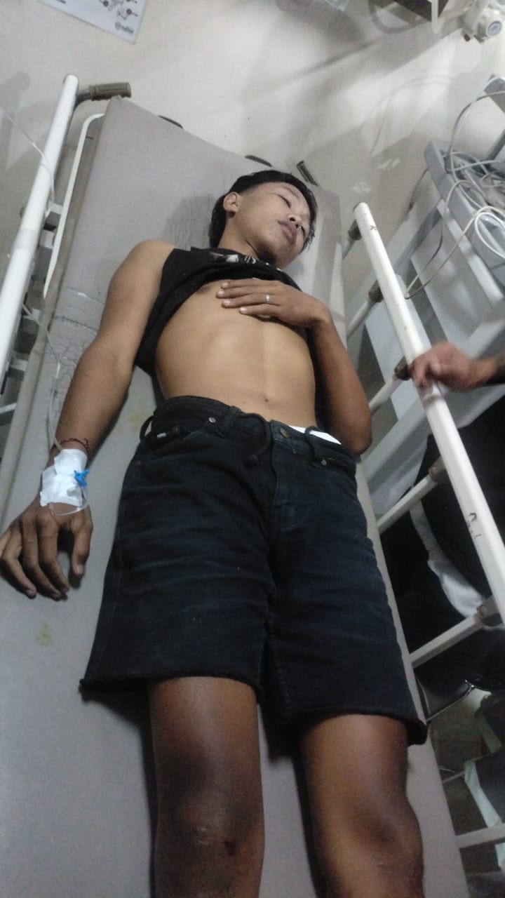 Gegara Anjing, Gede Juli Pratama Alami Patah Tulang Bahu: Begini ...