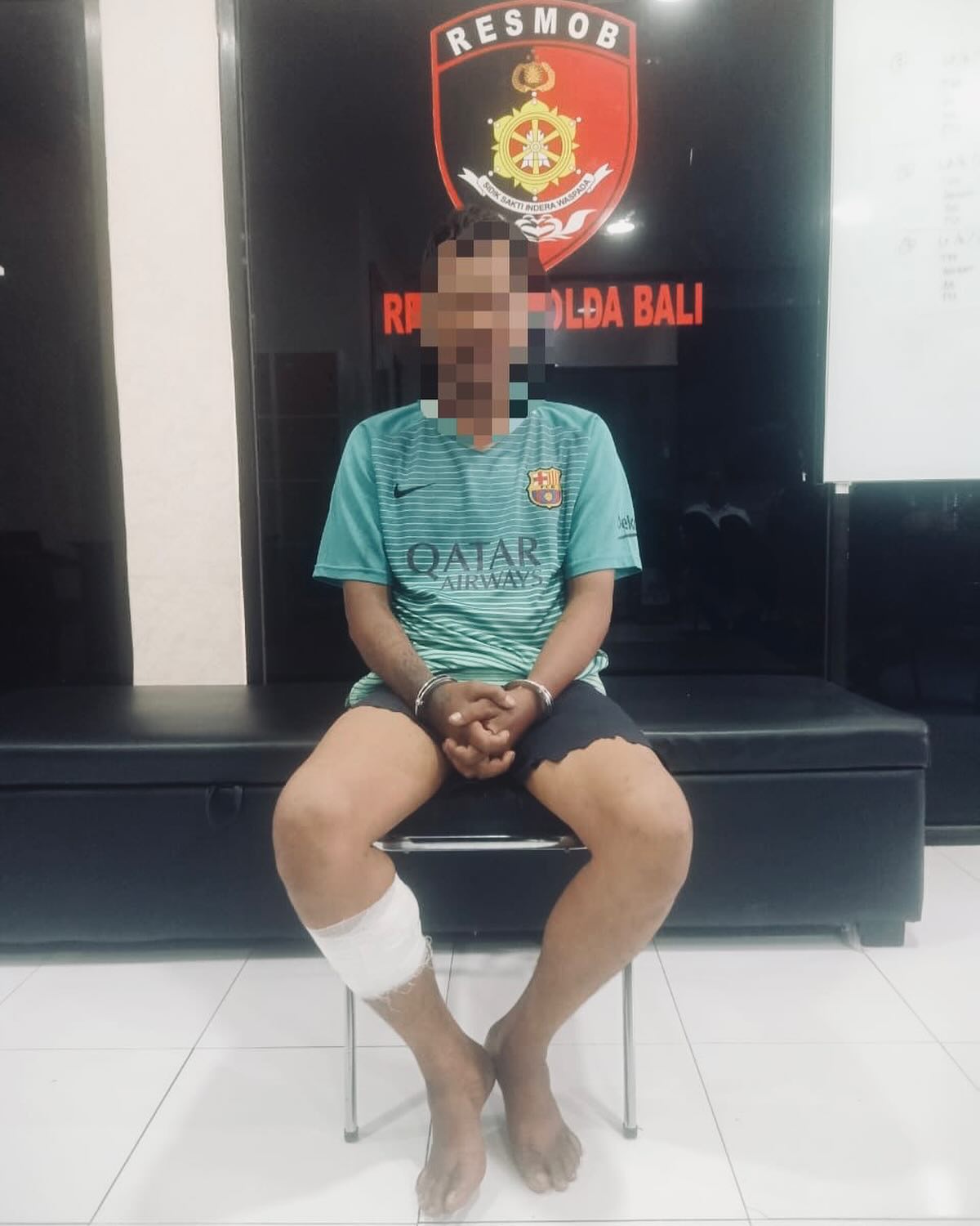 Didor: Kaki Bombom si maling kambuhan diperban karena didor polisi usai mencoba melawan. (Istimewa)