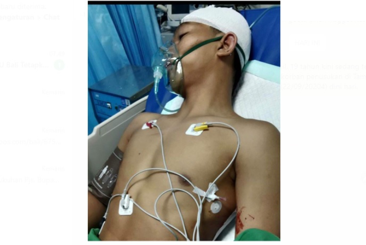 Afan Jamil Korban penusukan di Taman Pancing