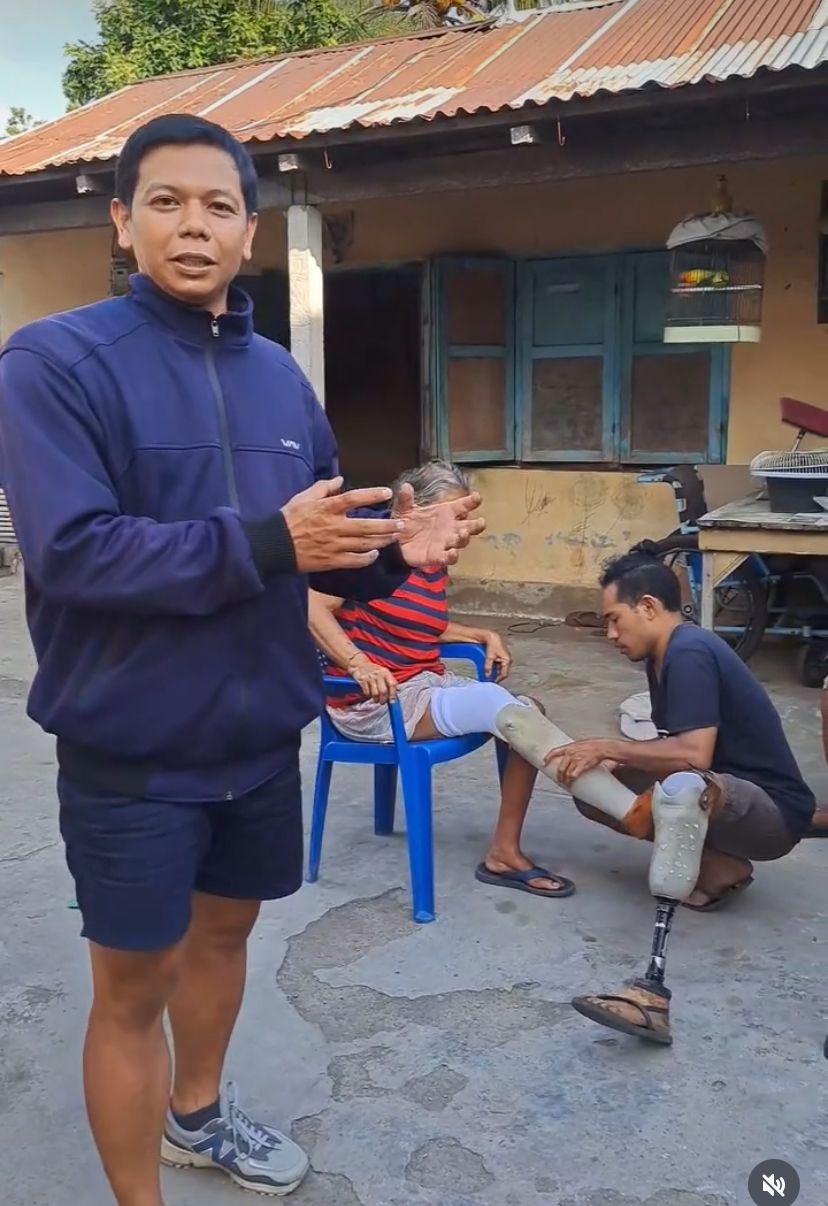 KAKI PALSU: Yayasan Kaki Kita memproduksi kaki palsu untuk penyandang diabetes yang mengalami amputasi kaki