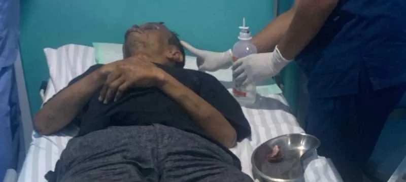 DIHAJAR MASSA : Muzamil Fadly harus dirawat di rumah sakit setelah babak belur dikeroyok massa. (istimewa)