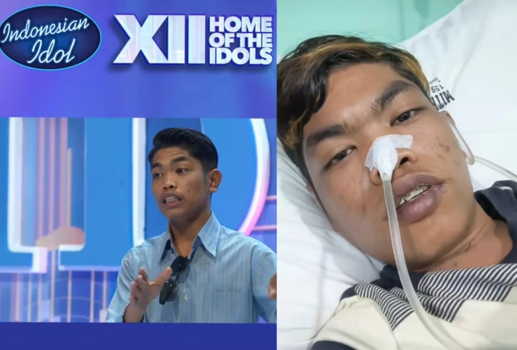Seorang mantan peserta audisi Indonesian Idol Adi Sitohang mencoba akhiri hidup gegara tak tahan di Bully