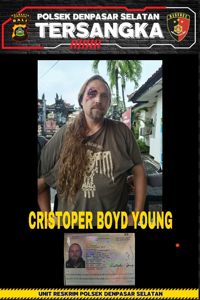 LUKA: Mata Christoper terluka karena tabrak mobil saat berusaha kabur dari aksi mencuri perhiasan. (Bali Express/Istimewa)