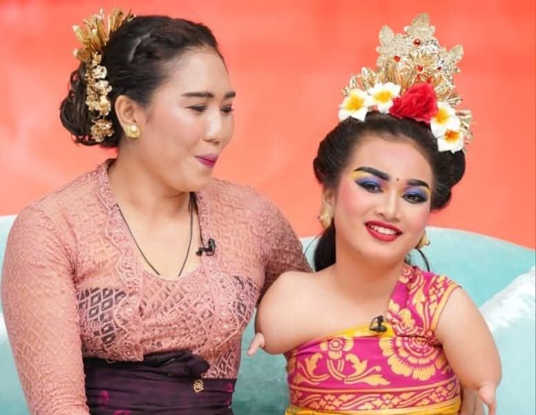 Ni Made Astini (kiri)