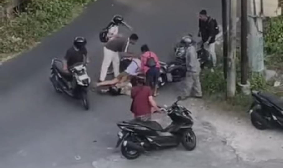 Seorang pengendara alami luka serius usai ditabrak lari oleh pengendara lain