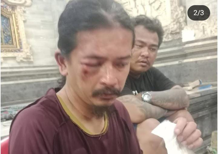 Kondisi seorang suami usai diduga dikeroyok warga usai buang sampah sembarangan