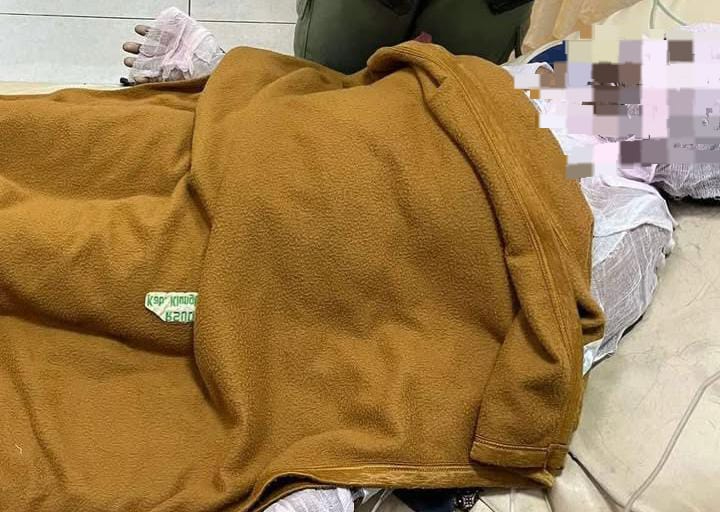 Ibu Wayan Mara Meninggal Terbakar Akibat Tabung LPG Bocor