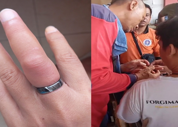 LAPOR : Warga meminta bantuan Damkar Klungkung untuk melepas cincin.