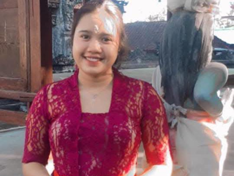 Kadek Melly Mudiani mahasiswi asal Buleleng alami kecelakaan di AS