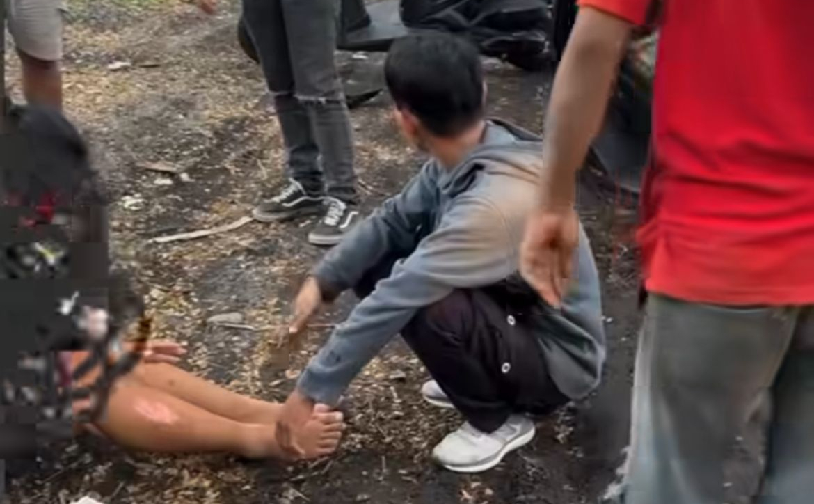 Seorang wanita alami luka serius usai alami kecelakaan