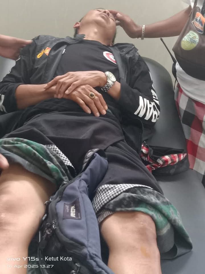 DIPUKUL: Salah seorang pecalang di Pura Agung Besakih mengalami luka memar di wajah karena dipukul oknum pamedek, Senin (14/4).