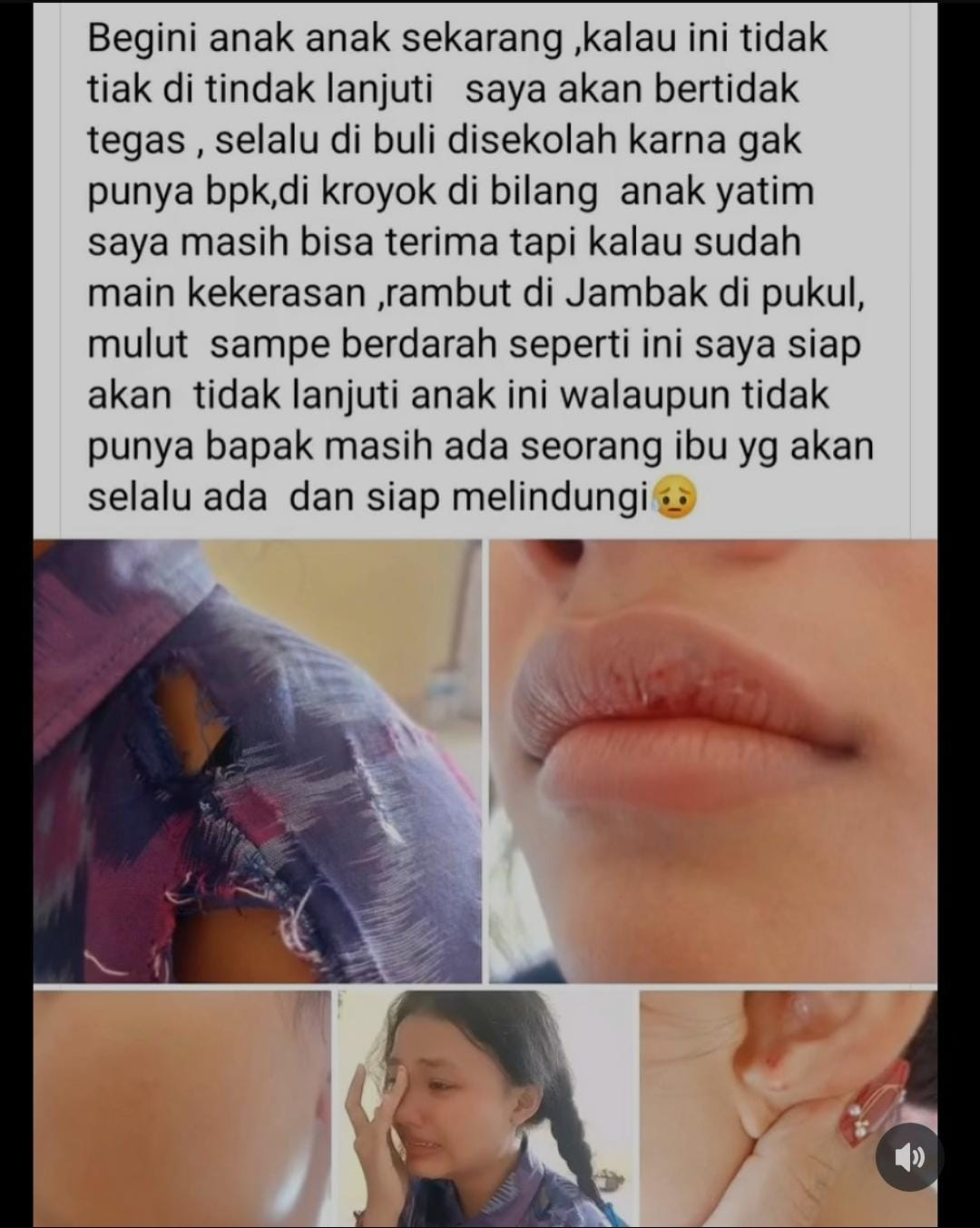 Kisah Pilu Anak Perempuan Jadi Korban Bullying Fisik dan Verbal di Sekolah