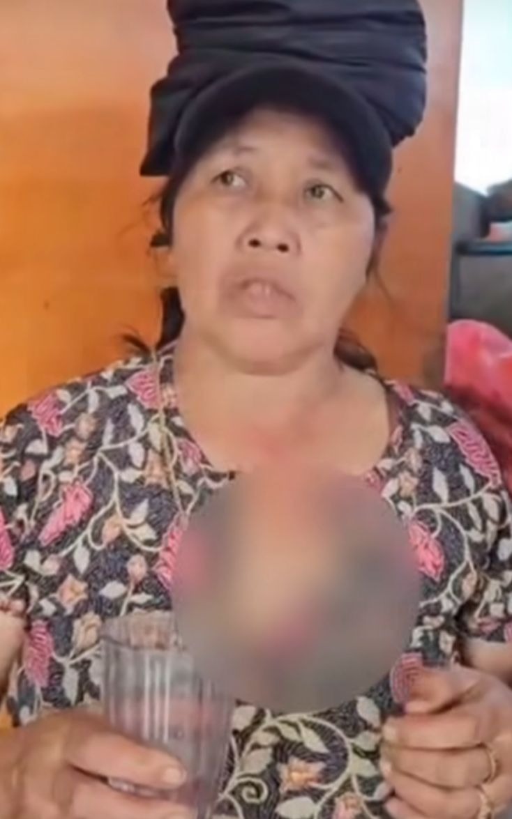 JAMBRET: Seorang ibu di Pacung, Baturiti, Tabanan nyaris jadi sasaran jambret dengan modus pura-pura mogok.