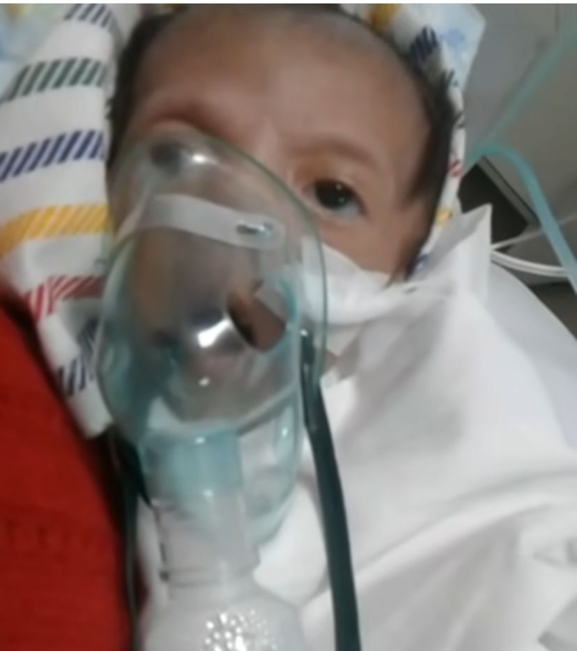 Bayi asal Singaraja menderita sejumlah penyakit dan membutuhkan bantuan